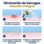 ChillErase® - Spray renovador para verrugas