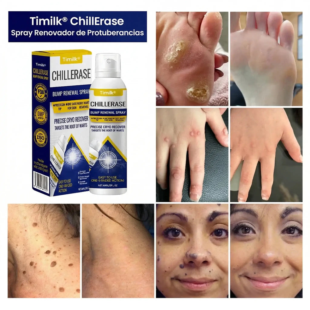 ChillErase® - Spray renovador para verrugas