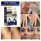 ChillErase® - Spray renovador para verrugas