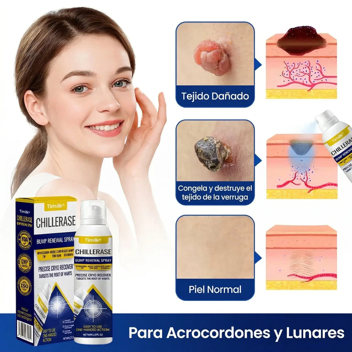 ChillErase® - Spray renovador para verrugas